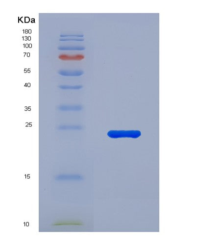 SDS-PAGE analysis of Human IL11 (Interleukin-11) - Recombinant Protein, showing >90% purity under 15% SDS-PAGE (Reduced)