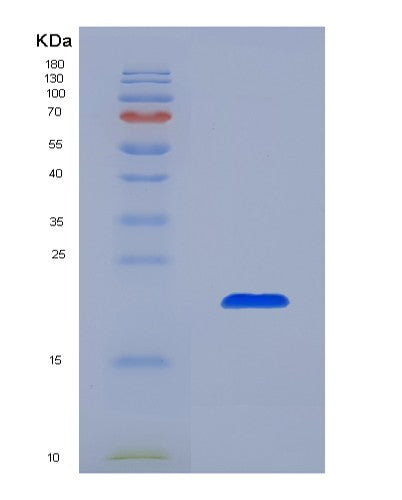 SDS-PAGE analysis of Human SHBG (Sex Hormone-Binding Globulin) - Recombinant Protein, showing >90% purity under 15% SDS-PAGE (Reduced)