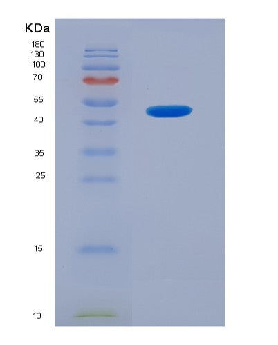 SDS-PAGE analysis of Human SHBG (Sex Hormone-Binding Globulin) - Recombinant Protein, showing >90% purity under 15% SDS-PAGE (Reduced)