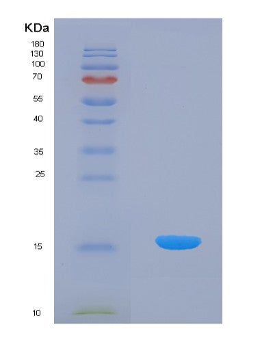SDS-PAGE analysis of Human CDA (Cytidine Deaminase) - Recombinant Protein, showing >90% purity under 15% SDS-PAGE (Reduced)