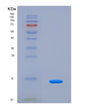 SDS-PAGE analysis of Mouse C5 (Complement C5) - Recombinant Protein, showing >90% purity under 15% SDS-PAGE (Reduced)