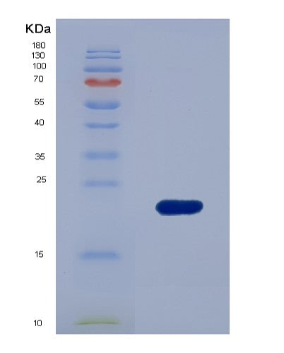 SDS-PAGE analysis of Human MANF (Mesencephalic Astrocyte-Derived Neurotrophic Factor) - Recombinant Protein, showing >90% purity under 15% SDS-PAGE (Reduced)
