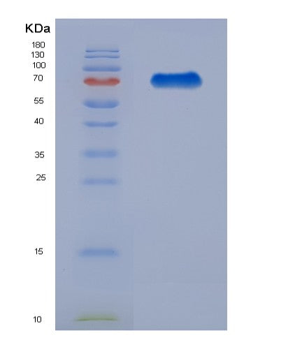 SDS-PAGE analysis of Human HRG (Histidine-Rich Glycoprotein) - Recombinant Protein, showing >90% purity under 15% SDS-PAGE (Reduced)
