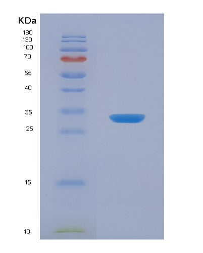 SDS-PAGE analysis of Human SOD3 (Extracellular Superoxide Dismutase [Cu-Zn]) - Recombinant Protein, showing >90% purity under 15% SDS-PAGE (Reduced)