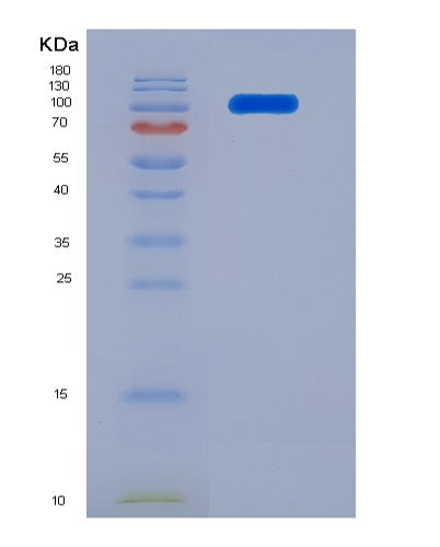 SDS-PAGE analysis of Human FGFR2 (Fibroblast Growth Factor Receptor 2) - Recombinant Protein, showing >90% purity under 15% SDS-PAGE (Reduced)