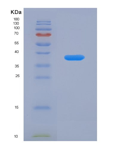 SDS-PAGE analysis of Human ADIPOQ (Adiponectin) - Recombinant Protein, showing >90% purity under 15% SDS-PAGE (Reduced)