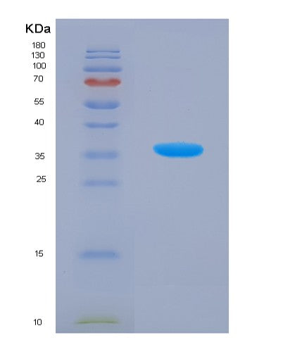SDS-PAGE analysis of Mouse Adipoq (Adiponectin) - Recombinant Protein, showing >90% purity under 15% SDS-PAGE (Reduced)