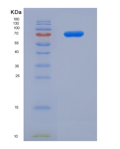 SDS-PAGE analysis of Human HAVCR2 (Hepatitis A Virus Cellular Receptor 2) - Recombinant Protein, showing >90% purity under 15% SDS-PAGE (Reduced)