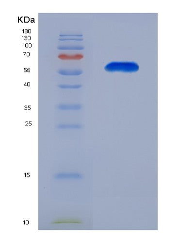 SDS-PAGE analysis of Human BTN3A1 (Butyrophilin Subfamily 3 Member A1) - Recombinant Protein, showing >90% purity under 15% SDS-PAGE (Reduced)