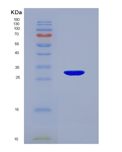 SDS-PAGE analysis of Human IGFBP1 (Insulin-Like Growth Factor-Binding Protein 1) - Recombinant Protein, showing >90% purity under 15% SDS-PAGE (Reduced)