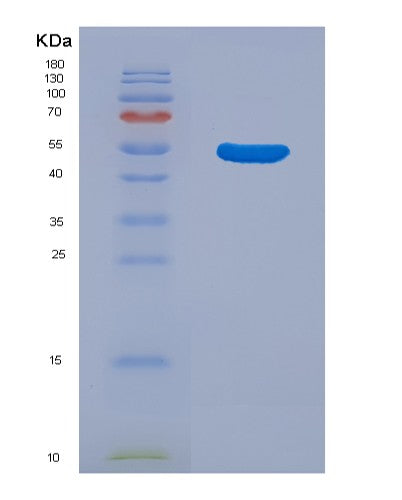 SDS-PAGE analysis of Human CD14 (Monocyte Differentiation Antigen Cd14) - Recombinant Protein, showing >90% purity under 15% SDS-PAGE (Reduced)