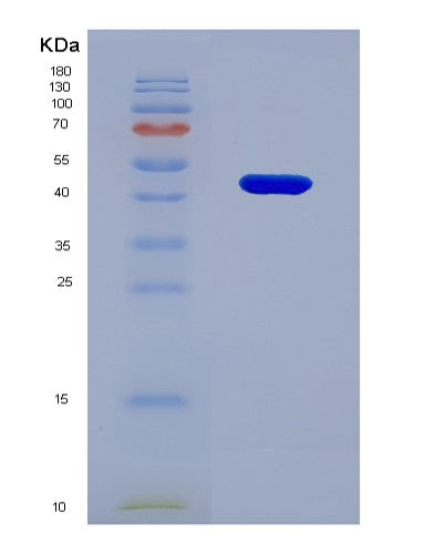 SDS-PAGE analysis of Human CD276 (Cd276 Antigen) - Recombinant Protein, showing >90% purity under 15% SDS-PAGE (Reduced)