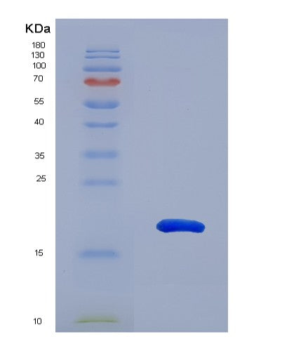 SDS-PAGE analysis of Human TIGIT (T-Cell Immunoreceptor With Ig And Itim Domains) - Recombinant Protein, showing >90% purity under 15% SDS-PAGE (Reduced)