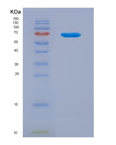SDS-PAGE analysis of Human THBD (Thrombomodulin) - Recombinant Protein, showing >90% purity under 15% SDS-PAGE (Reduced)