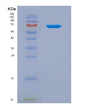SDS-PAGE analysis of Human THBD (Thrombomodulin) - Recombinant Protein, showing >90% purity under 15% SDS-PAGE (Reduced)