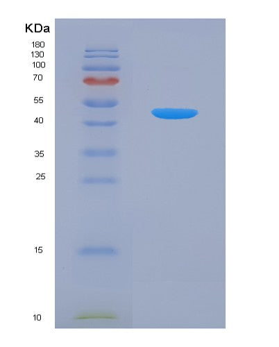 SDS-PAGE analysis of Human CD38 (Adp-Ribosyl Cyclase/Cyclic Adp-Ribose Hydrolase 1) - Recombinant Protein, showing >90% purity under 15% SDS-PAGE (Reduced)