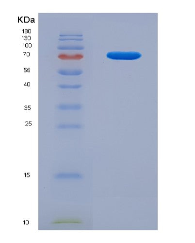 SDS-PAGE analysis of Human NECTIN1 (Nectin-1) - Recombinant Protein, showing >95% purity under 15% SDS-PAGE (Reduced)