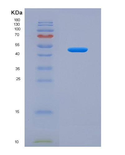 SDS-PAGE analysis of Human DKK3 (Dickkopf-Related Protein 3) - Recombinant Protein, showing >85% purity under 15% SDS-PAGE (Reduced)