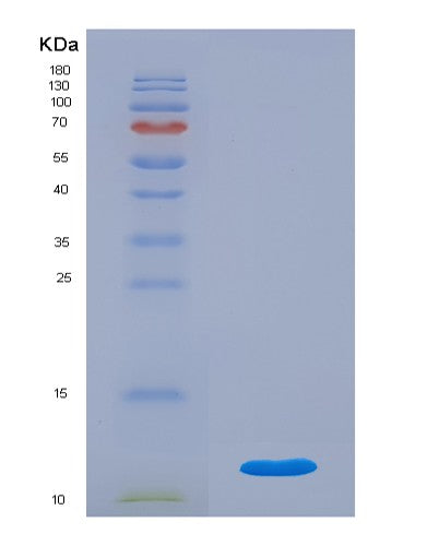 SDS-PAGE analysis of Human C4B (Complement C4-B) - Recombinant Protein, showing >90% purity under 15% SDS-PAGE (Reduced)