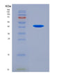 SDS-PAGE analysis of Human C4A (Complement C4-A) - Recombinant Protein, showing >90% purity under 15% SDS-PAGE (Reduced)