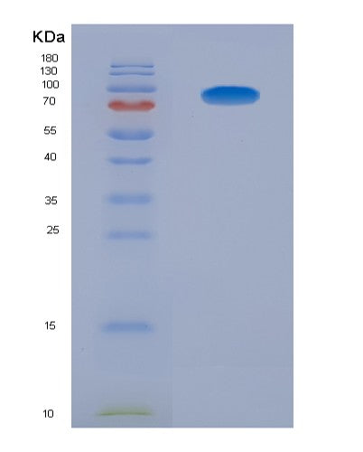 SDS-PAGE analysis of Human AGER (Advanced Glycosylation End Product-Specific Receptor) - Recombinant Protein, showing >85% purity under 15% SDS-PAGE (Reduced)