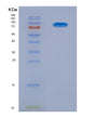 SDS-PAGE analysis of Human AGER (Advanced Glycosylation End Product-Specific Receptor) - Recombinant Protein, showing >85% purity under 15% SDS-PAGE (Reduced)
