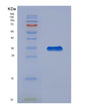 SDS-PAGE analysis of Human IGFBP4 (Insulin-Like Growth Factor-Binding Protein 4) - Recombinant Protein, showing >95% purity under 15% SDS-PAGE (Reduced)
