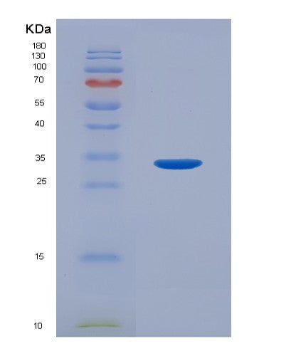 SDS-PAGE analysis of Human STAT6 (Signal Transducer And Activator Of Transcription 6) - Recombinant Protein, showing >90% purity under 15% SDS-PAGE (Reduced)