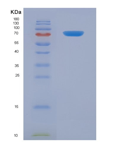 SDS-PAGE analysis of Human GHR (Growth Hormone Receptor) - Recombinant Protein, showing >90% purity under 15% SDS-PAGE (Reduced)