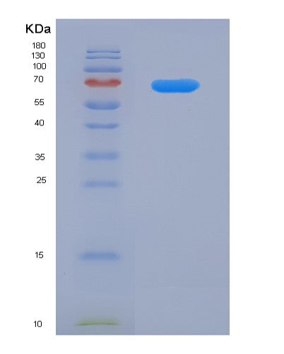 SDS-PAGE analysis of Human CX3CL1 (Fractalkine) - Recombinant Protein, showing >95% purity under 15% SDS-PAGE (Reduced)