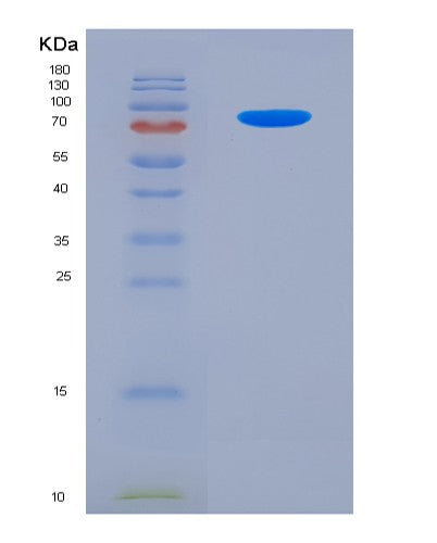 SDS-PAGE analysis of Human PVR (Poliovirus Receptor) - Recombinant Protein, showing >85% purity under 15% SDS-PAGE (Reduced)