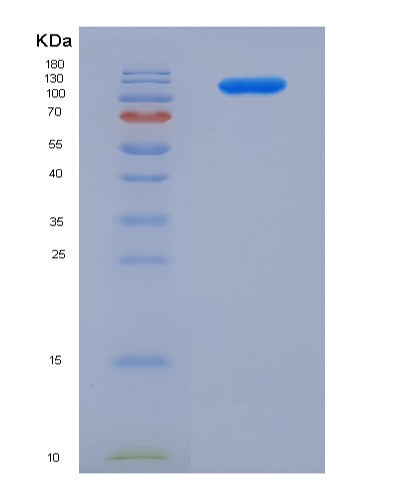SDS-PAGE analysis of Human CD22 (B-Cell Receptor Cd22) - Recombinant Protein, showing >85% purity under 15% SDS-PAGE (Reduced)