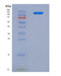 SDS-PAGE analysis of Human CD22 (B-Cell Receptor Cd22) - Recombinant Protein, showing >85% purity under 15% SDS-PAGE (Reduced)