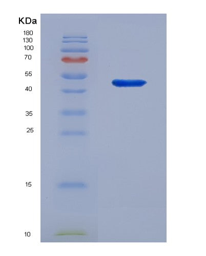 SDS-PAGE analysis of Human CD5 (T-Cell Surface Glycoprotein Cd5) - Recombinant Protein, showing >90% purity under 15% SDS-PAGE (Reduced)