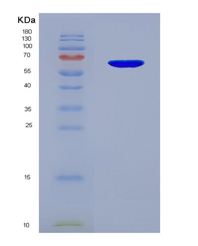 SDS-PAGE analysis of Human FGFR1 (Fibroblast Growth Factor Receptor 1) - Recombinant Protein, showing >85% purity under 15% SDS-PAGE (Reduced)