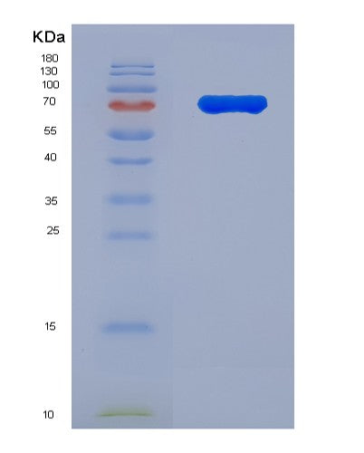 SDS-PAGE analysis of Human IL1RL2 (Interleukin-1 Receptor-Like 2) - Recombinant Protein, showing >85% purity under 15% SDS-PAGE (Reduced)