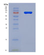 SDS-PAGE analysis of Human IL1RL2 (Interleukin-1 Receptor-Like 2) - Recombinant Protein, showing >85% purity under 15% SDS-PAGE (Reduced)