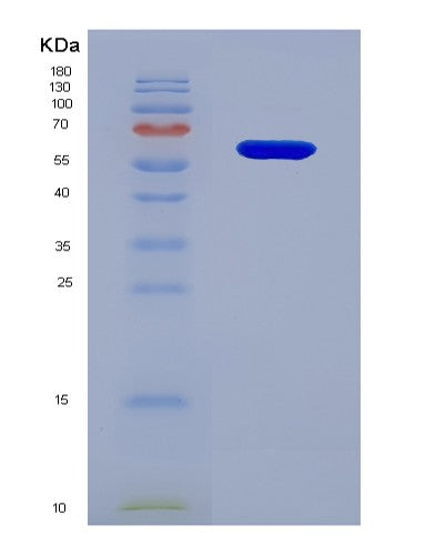SDS-PAGE analysis of Human IL20RB (Interleukin-20 Receptor Subunit Beta) - Recombinant Protein, showing >85% purity under 15% SDS-PAGE (Reduced)