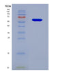 SDS-PAGE analysis of Human IL20RB (Interleukin-20 Receptor Subunit Beta) - Recombinant Protein, showing >85% purity under 15% SDS-PAGE (Reduced)