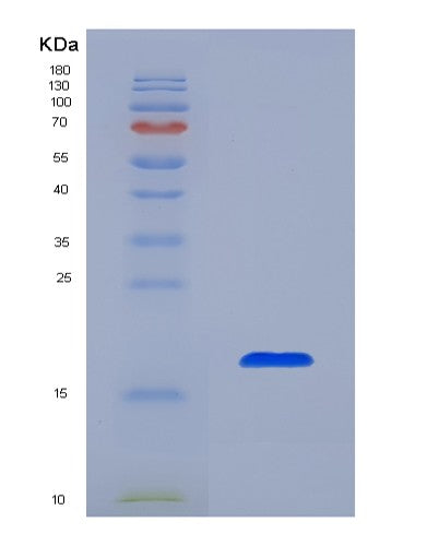 SDS-PAGE analysis of Human IL36B (Interleukin-36 Beta) - Recombinant Protein, showing >90% purity under 15% SDS-PAGE (Reduced)