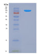 SDS-PAGE analysis of Human PDGFRA (Platelet-Derived Growth Factor Receptor Alpha) - Recombinant Protein, showing >90% purity under 15% SDS-PAGE (Reduced)