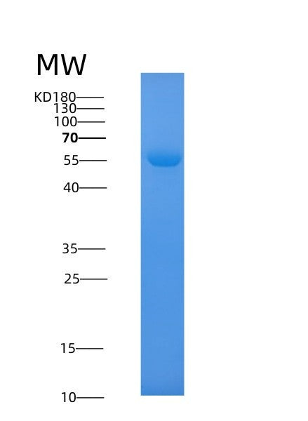 SDS-PAGE analysis of Human SHMT1 (Serine Hydroxymethyltransferase, Cytosolic) - Recombinant Protein, showing >85% purity under 15% SDS-PAGE (Reduced)