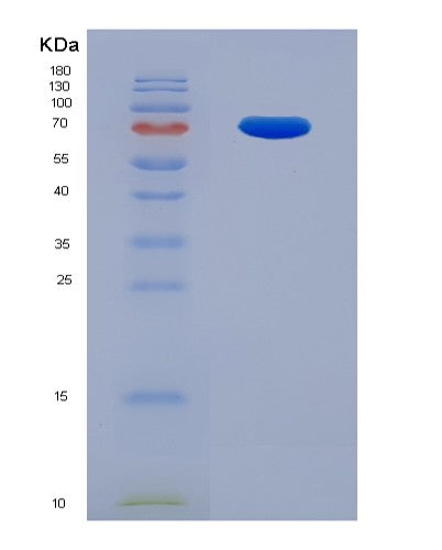 SDS-PAGE analysis of Human IFNAR1 (Interferon Alpha/Beta Receptor 1) - Recombinant Protein, showing >90% purity under 15% SDS-PAGE (Reduced)