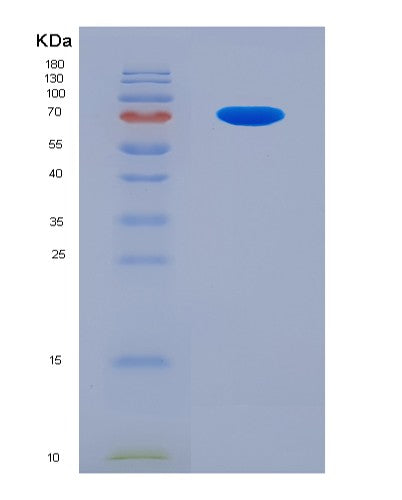 SDS-PAGE analysis of Human IL18R1 (Interleukin-18 Receptor 1) - Recombinant Protein, showing >90% purity under 15% SDS-PAGE (Reduced)