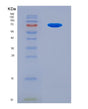SDS-PAGE analysis of Human IL18R1 (Interleukin-18 Receptor 1) - Recombinant Protein, showing >90% purity under 15% SDS-PAGE (Reduced)