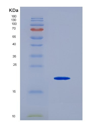 SDS-PAGE analysis of Human APP (Amyloid-Beta Precursor Protein) - Recombinant Protein, showing >90% purity under 15% SDS-PAGE (Reduced)