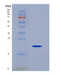 SDS-PAGE analysis of Human APP (Amyloid-Beta Precursor Protein) - Recombinant Protein, showing >90% purity under 15% SDS-PAGE (Reduced)