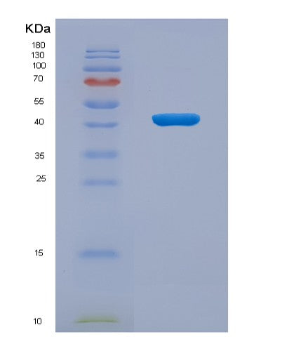 SDS-PAGE analysis of Human IL2RG (Cytokine Receptor Common Subunit Gamma) - Recombinant Protein, showing >95% purity under 15% SDS-PAGE (Reduced)