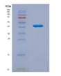 SDS-PAGE analysis of Human IL2RG (Cytokine Receptor Common Subunit Gamma) - Recombinant Protein, showing >95% purity under 15% SDS-PAGE (Reduced)