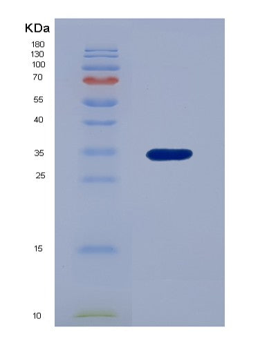 SDS-PAGE analysis of Human FOLR1 (Folate Receptor Alpha) - Recombinant Protein, showing >85% purity under 15% SDS-PAGE (Reduced)